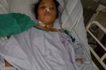 Kinh hoàng 40 con giun làm tổ trong ống mật chủ