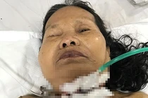 Phụ cháu mổ gà, bà nội trượt chân bị dao đâm xuyên cổ