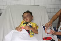 Bé 4 tuổi bị cha dượng, mẹ đẻ hành hung chấn thương sọ não?