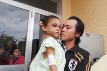 Bé 4 tuổi bị cha mẹ bạo hành: Cha đẻ lộ diện
