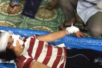 Rúng động Bắc Giang: Chồng cắt gân tay, gân chân vợ dã man