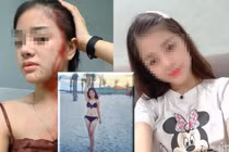 Hồng nhan bạc phận, những cô gái xinh đẹp bị chồng vũ phu đánh bầm dập