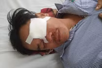 Khởi tố thiếu nữ 23 tuổi cho vay nặng lãi, đâm mù mắt con nợ