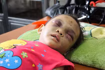 Bé 4 tuổi bị cha mẹ bạo hành: Kẻ thủ ác là cha dượng