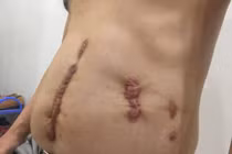 Bị đâm nhiều nhát khi đi mua súng phòng thân