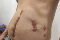 Bị đâm nhiều nhát khi đi mua súng phòng thân