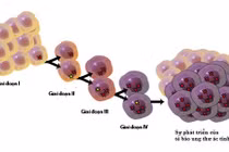 8 hiểu nhầm vô cùng nguy hại về bệnh ung thư