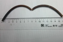 Kinh hãi dị vật nằm suốt 20 năm trong tá tràng