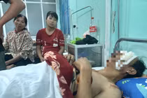 Nạn nhân xe biển xanh gây tai nạn: Chỉ mong bố tỉnh lại