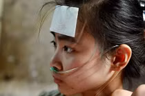 Hình ảnh đau lòng thiếu nữ Hà Nội xinh đẹp mắc bệnh hiểm