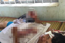 "Cát tặc" chém Xã đội trưởng nhập viện khi đang làm nhiệm vụ