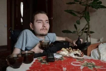 Những rủi ro đáng sợ khi ghép đầu người