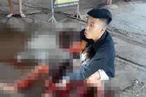 Nam thanh niên đang đi trên đường bất ngờ bị đâm nhập viện