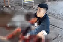 Nam thanh niên đang đi trên đường bất ngờ bị đâm nhập viện