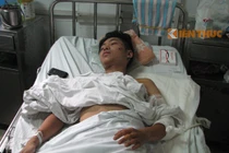 Nạn nhân vụ nổ ngõ Thông Phong kể phút gặp họa