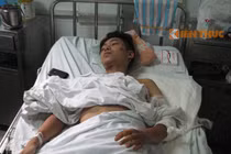 Nạn nhân vụ nổ ngõ Thông Phong kể phút gặp họa