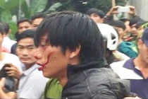 Vụ ngáo đá chém chết bác ruột: Nghi phạm từng là con ngoan