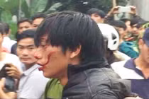 Vụ ngáo đá chém chết bác ruột: Nghi phạm từng là con ngoan