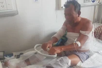 Rò rỉ khí gas, 2 vợ chồng bị bỏng nặng