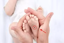 Trẻ có 4 nốt ruồi tượng trưng Tài - Lộc - Phúc, trọn đời may mắn