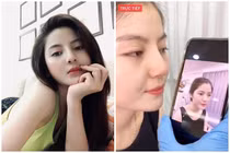 “Bạn gái tin đồn” của Quang Hải lộ ảnh trước phẫu thuật thẩm mỹ