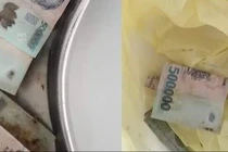 Hy hữu người phụ nữ nuốt 12,5 triệu đồng tiền polyme vào bụng