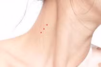 4 nốt ruồi Tiền - Tình - Danh, ai có 1/4 số đỏ như son