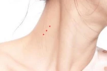 4 nốt ruồi Tiền - Tình - Danh, ai có 1/4 số đỏ như son