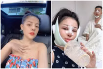 Hiếm hoi công khai sửa mặt, Ngân 98 bị antifan mỉa mai
