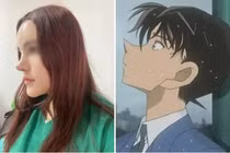 Phẫu thuật nâng mũi như “cầu trượt”, cô gái trẻ khiến CĐM xôn xao