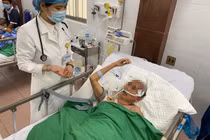 Thanh niên 27 tuổi nguy kịch do đột quỵ sau cơn đau đầu dữ dội