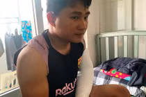 Giao hàng không nhận, vợ chồng Quảng Ngãi đánh shipper gãy tay