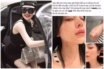 “Đối thủ” Ngọc Trinh bị hành hung giữa drama với “nữ hoàng nội y“?