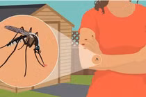 Cần tránh xa 4 màu quần áo này nếu không muốn bị muỗi đốt