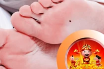Người có nốt ruồi ở vị trí này cả đời không lo đói khổ