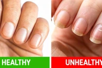 8 “dấu hiệu” bệnh tật nguy hiểm mà chúng ta thường bỏ qua 