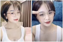 Lộ vòng 1 to bất thường, “thánh nữ bi-a” bị nghi “dao kéo“