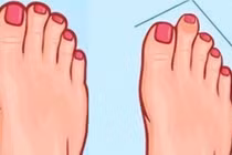 Trắc nghiệm tâm lý: Bàn chân của bạn có hình dạng nào sau đây? 