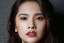 Những nốt ruồi trên mặt "gọi tài chiêu lộc", chớ dại tẩy xóa 