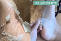 lột da chân trên Tik Tok 