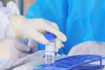 Ngày 27/2: Số mắc COVID-19 mới tăng vọt lên 86.990 ca