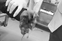 Hai học sinh thương vong sau tiếng nổ lớn trong đêm