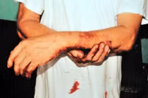 Côn đồ “dàn trận”, chở bao tải hung khí trấn áp dân