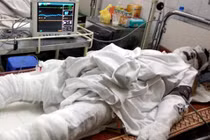 Xót xa 2 công nhân thoát chết trong vụ điện giật