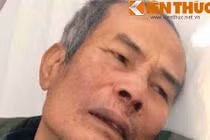 Cụ ông làm bảo vệ bị khách đánh chấn thương sọ não