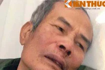 Cụ ông làm bảo vệ bị khách đánh chấn thương sọ não