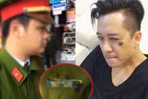 Có hay không việc ca sĩ Tuấn Hưng đánh công an phường?