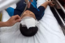 Sập trần trường mầm non, 6 học sinh nhập viện