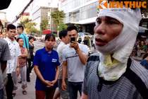 Công nhân bị bỏng kể về vụ cháy kinh hoàng ở xưởng gỗ