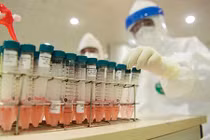 Bệnh nhân COVID-19 thứ 92 tái dương tính nhưng không lây nhiễm cho ai